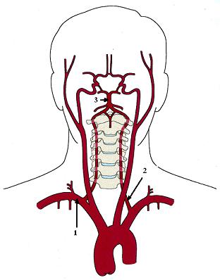Fig. 2. Anatomy of vertebral arteries