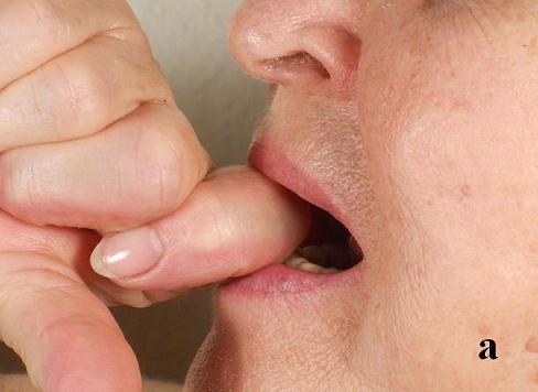 Fig.3a. Before first session