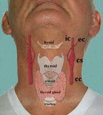 Fig. 3. Anatomy of carotid arteries and carotid sinuses