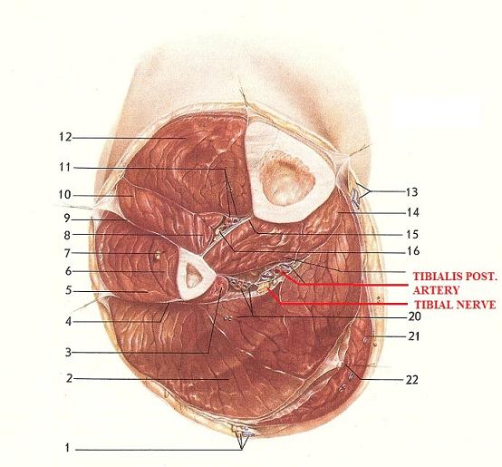Fig. 2. Cross section of the leg on the border between upper and middle thirds