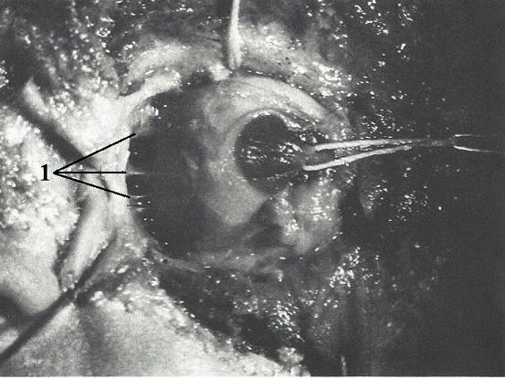 Fig. 8. Connective tissue septae of the left eyeball (Koornneef, 1982)
