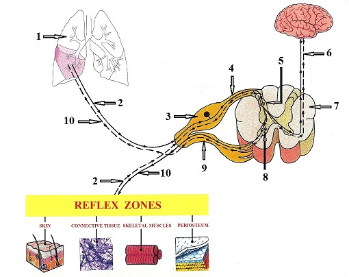 Fig. 5. Formation of reflex zones in the soft tissue
