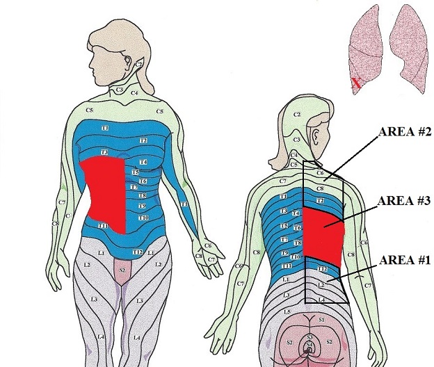 Fig. 1. Main target area for massage in cases of pneumonia located in the right lower lobe