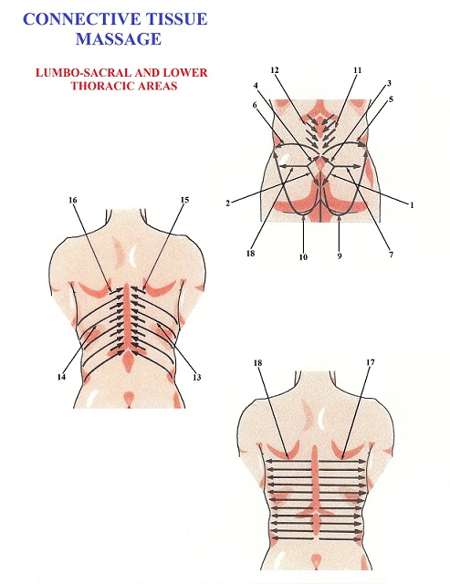 Fig. 4. Protocol of CTM in the lower back