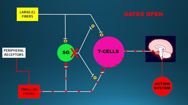 Fig. 3. The Gate Control System when inappropriate pressure is used during bodywork