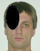 Pain pattern for Headache Greater Occipital Nerve Neuralgia