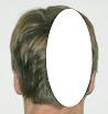 Pain pattern for Headache Greater Occipital Nerve Neuralgia