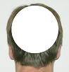 Pain pattern for Migraine Vertigo Benign Positioning Vertigo