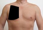 Pain pattern for Pectoralis Major Muscle Syndrome Thoracalgia False Cardialgia Syndrome