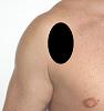 Pain pattern for Pectoralis Minor Muscle Syndrome Pectoralis Major Muscle Syndrome Axillar Nerve Neuralgia