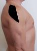 Pain pattern for Deltoid Muscle Syndrome Axillar Nerve Neuralgia Rhomboideus Major and Minor Muscle Syndrome Anterior Scalene Muscle Syndrome