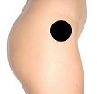 Pain pattern for Tensor Fasciae Latae Muscle Syndrome