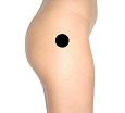 Pain pattern for Trochanteritis