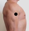 Pain pattern for Deltoid Muscle Syndrome