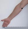 Pain pattern for Golfer's Elbow Medial Epicondylitis of the Humerus