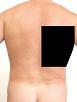 Pain pattern for Thoracalgia Intercostal Nerve Neuralgia