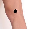 Pain pattern for Injury of the Lateral Collateral Ligament (LCL) of the Knee Lateral Epicondylitis of the Femur