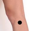 Pain pattern for Injury of the Lateral Collateral Ligament (LCL) of the Knee Lateral Epicondylitis of the Tibia