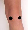 Pain pattern for Menisci Injury
