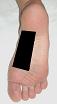 Pain pattern for Plantar Fasciitis