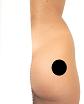 Pain pattern for Piriformis Muscle Syndrome