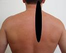 Pain pattern for Trapezius Muscle Syndrome Cervical Pain Headache Greater Occipital Nerve Neuralgia Cervicocranialgia