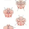 Set 2. Protocol of Connective Tissue Massage - Image 4
