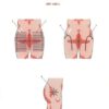 Set 2. Protocol of Connective Tissue Massage - Image 10
