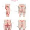 Set 2. Protocol of Connective Tissue Massage - Image 11