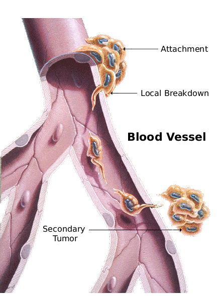 Science of Massage Institute » Science of Oncology Massage, Part 1