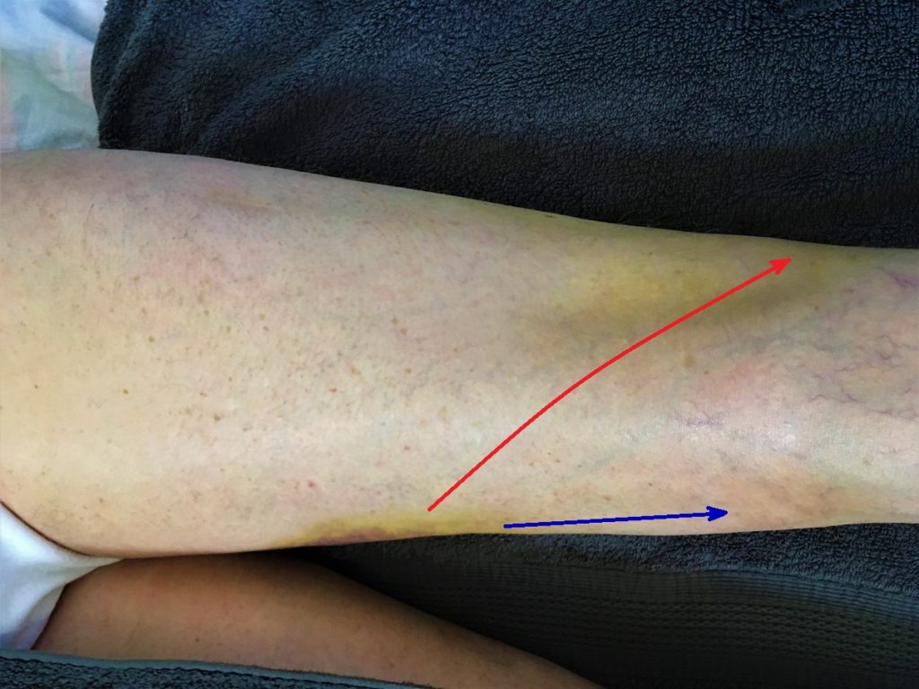 Medical Massage Courses & Certification Science of Massage Institute