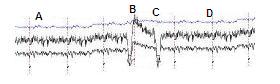 Fig. 1. Normal EEG and its correlation with the visual system