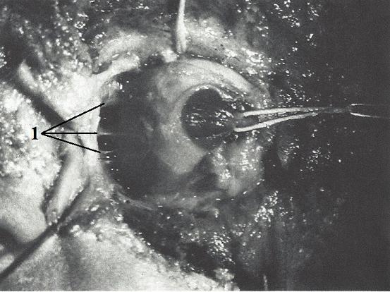 Fig. 8. Connective tissue septa of the left eyeball (Koornneef, 1982)