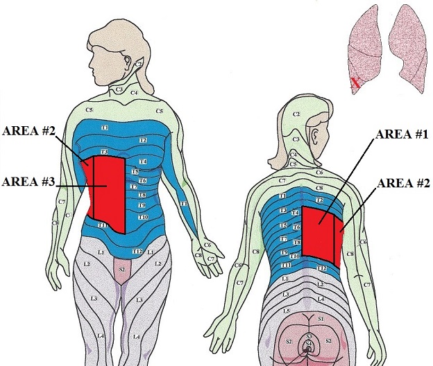 Fig. 2. Sequence of therapy in main therapeutic area along the horizontal axis