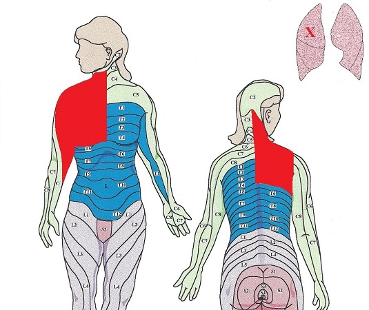 Fig. 3. Upper lobe of the right lung