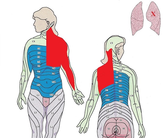 Fig. 3. Upper lobe of the left lung