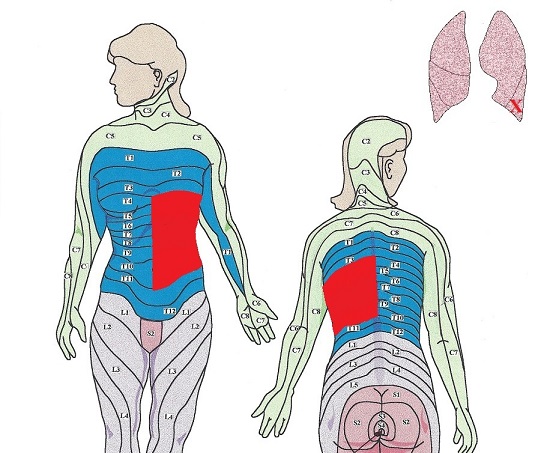 Fig. 3. Lower lobe of the left lung