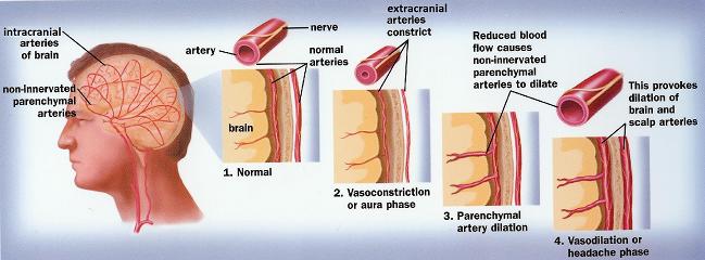 Fig. 1. Vascular abnormalities during MG