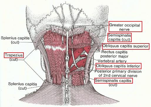 Fig. 1. Possible areas of greater occipital nerve compression (Travell and Simons, 1983)
