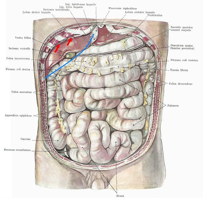 Fig. 2. Anterior abdomen with the liver exposed