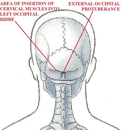 Fig. 2. Posterior skull and occipital ridge