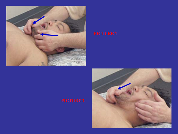 Fig. 3. Passive stretching of the masseter muscle while applying deep-tissue work