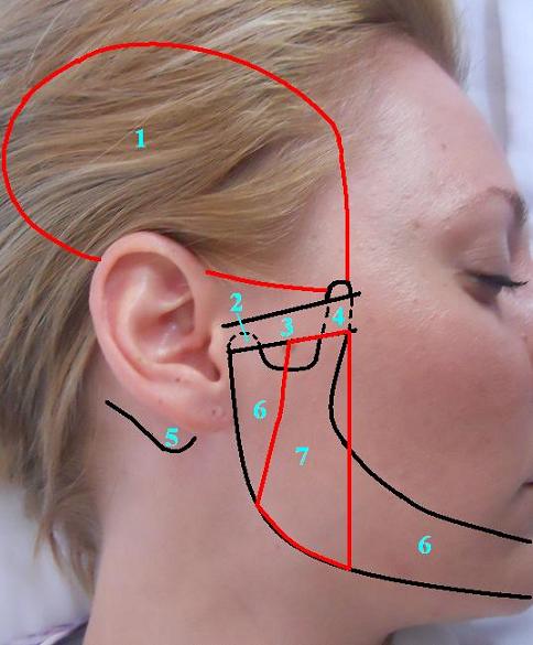 Fig.2. Anatomical landmarks in the area of TMJ