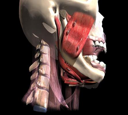 Fig. 2. Trigger points in the masseter muscle