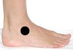 Pain pattern for Sprained ankle joint