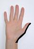 Pain pattern for Radial Nerve Neuralgia Anterior Scalene Muscle Syndrome Pectoralis Minor Muscle Syndrome